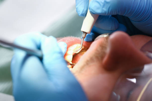 Best Emergency Treatment for Toothache in Lake Hamilton, AR
