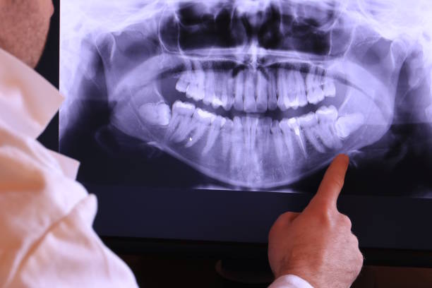 Best Emergency Dental Care for Trauma or Injury in Lake Hamilton, AR